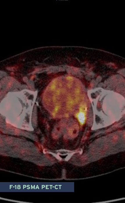 Nuklearmedizin, MRT (Magnetresonanztomographie) | Röntgenaufnahmen | Praxis für Radiologie & Nuklearmedizin