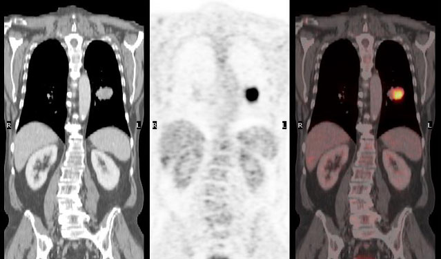 Radiologische Diagnostik, CT (Computertomographie) | Strahlenexposition | Praxis für Radiologie & Nuklearmedizin