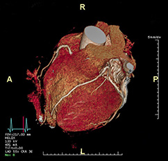 Ultraschalluntersuchungen, CT (Computertomographie) | Radiologischer Befund | Praxis für Radiologie & Nuklearmedizin