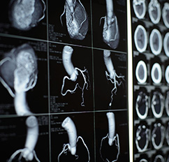 CT (Computertomographie), MRT (Magnetresonanztomographie) | Strahlenexposition | Praxis für Radiologie & Nuklearmedizin