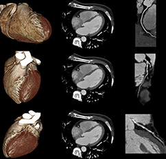 Ultraschalluntersuchungen, MRT (Magnetresonanztomographie) | Strahlenexposition | Praxis für Radiologie & Nuklearmedizin