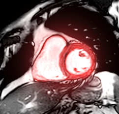 MRT (Magnetresonanztomographie), Ultraschalluntersuchungen | Röntgenaufnahmen | Praxis für Radiologie & Nuklearmedizin