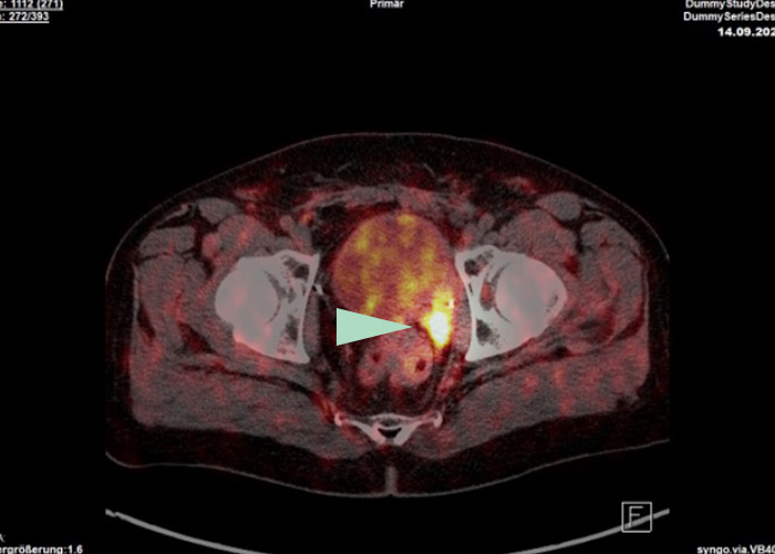 Bildgebende Verfahren, Ultraschalluntersuchungen | Radiologischer Befundbericht | Praxis für Radiologie & Nuklearmedizin