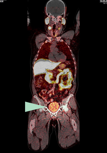 Radiologische Diagnostik, Nuklearmedizin | Röntgenaufnahmen | Praxis für Radiologie & Nuklearmedizin