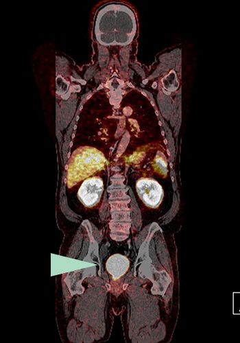 Bildgebende Verfahren, Ultraschalluntersuchungen | Radiologischer Befund | Praxis für Radiologie & Nuklearmedizin