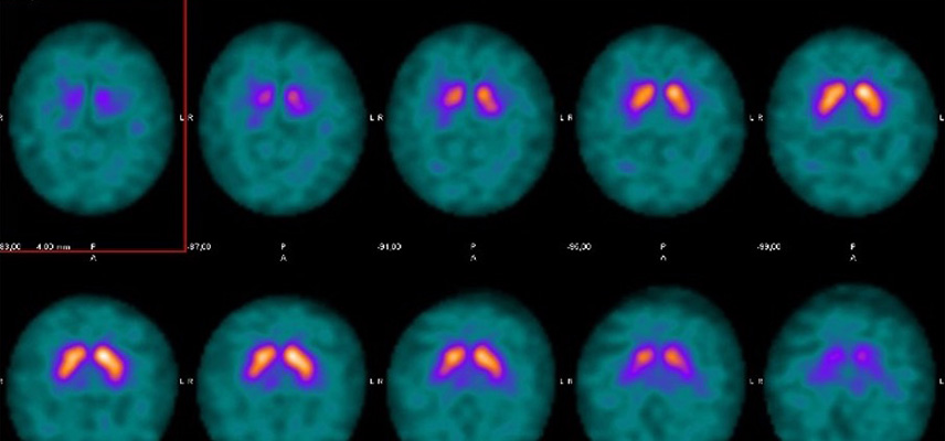 Ultraschalluntersuchungen, MRT (Magnetresonanztomographie) | Strahlenexposition | Praxis für Radiologie & Nuklearmedizin