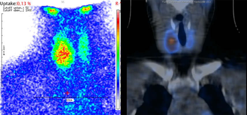 CT (Computertomographie), Radiologisches Gutachten | Strahlenexposition | Praxis für Radiologie & Nuklearmedizin